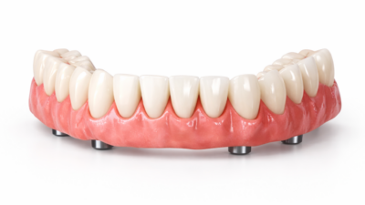 Dental Implants Arch