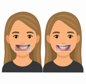 Kerry Voit DDS Dental Implants Before and After-Ill Fitting Partial